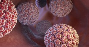 Infeksi HPV